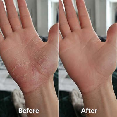 92% Reported Real Results With Antarctic Krill Oil